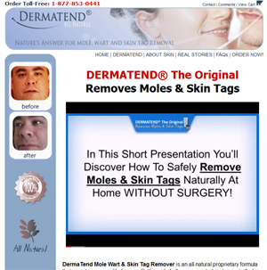 Dermatend